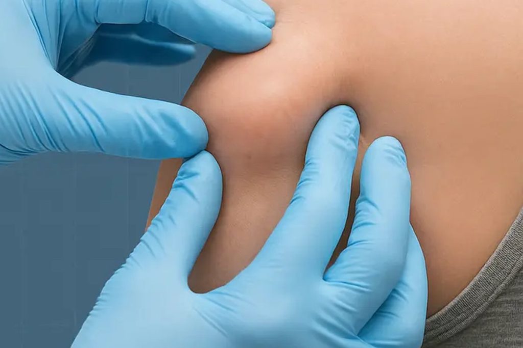 Clinician examining a patient's skin